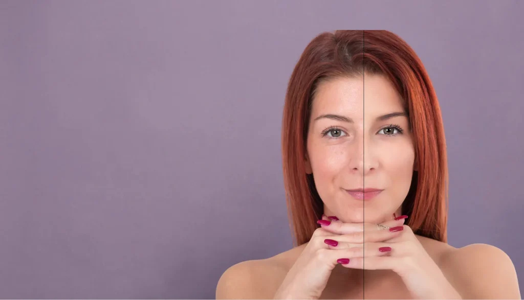 Zašto mnogi uzimaju kolagen, ali nemaju očekivane rezultate? For Collagen Hrvatska before after